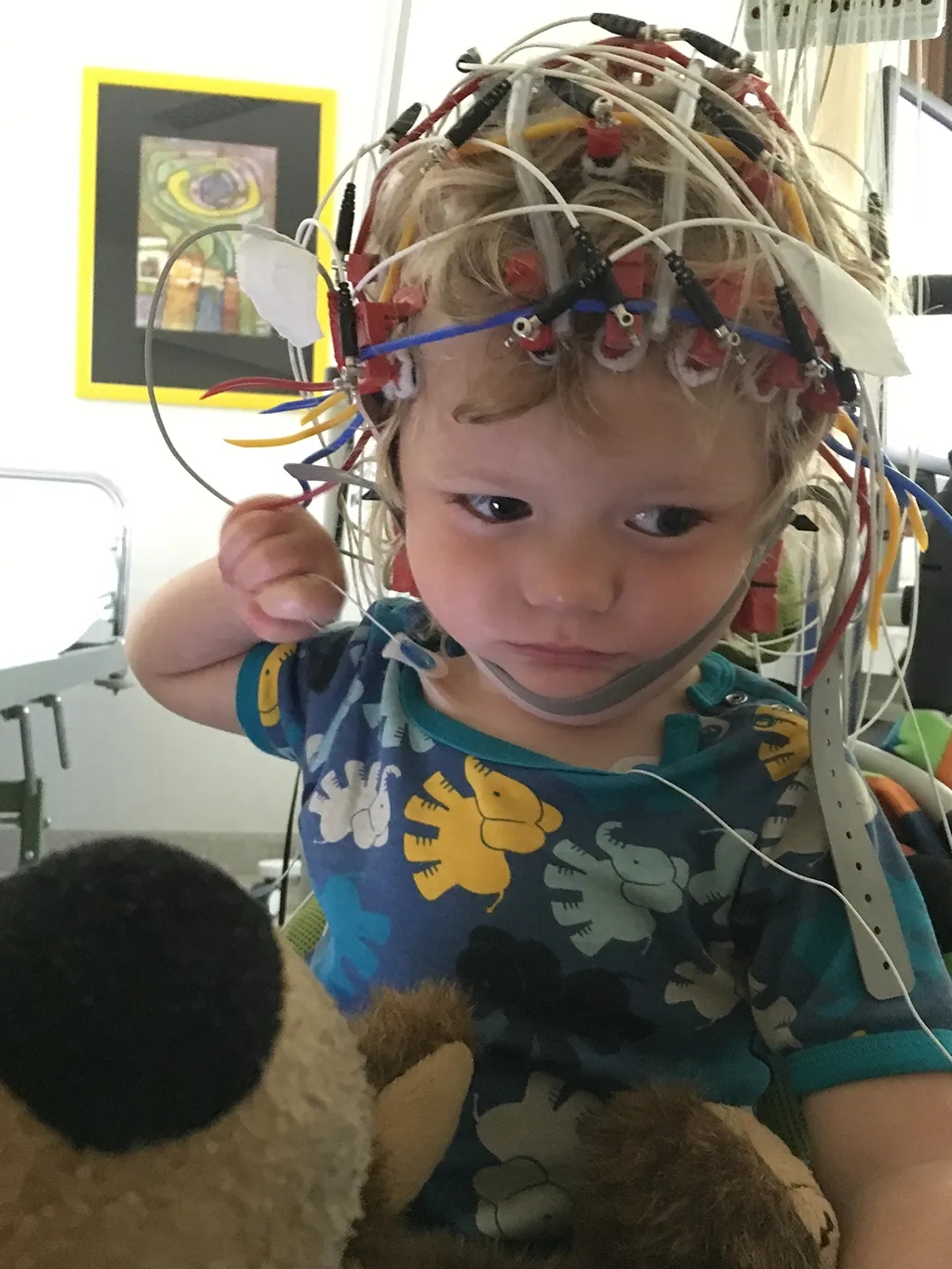 Junge beim EEG mit vielen Kabeln